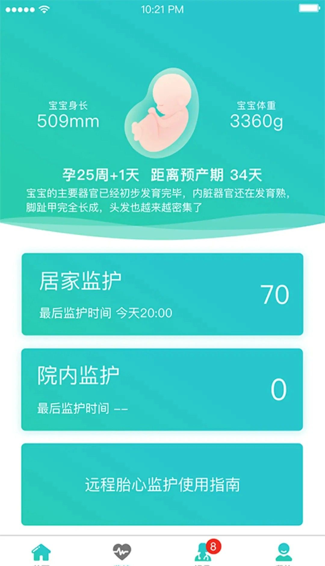 胎心监护